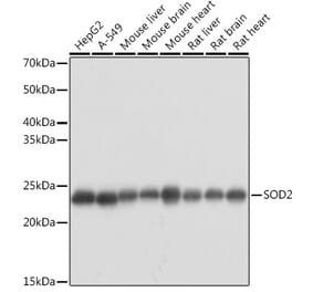 Western Blot - Anti-SOD2/MnSOD Antibody (A13432) - Antibodies.com