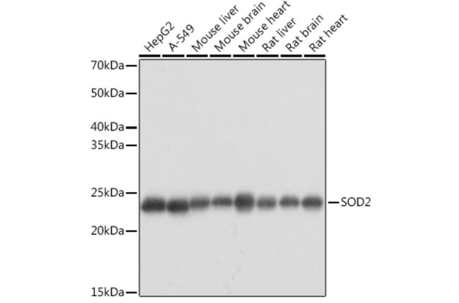 Western Blot - Anti-SOD2/MnSOD Antibody (A13432) - Antibodies.com