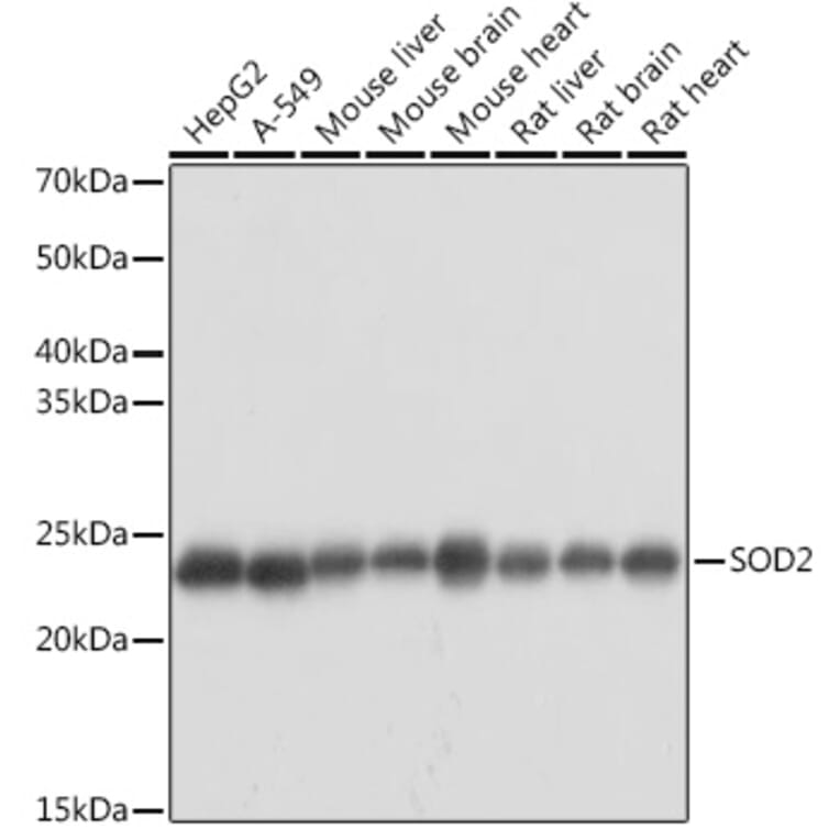 Western Blot - Anti-SOD2/MnSOD Antibody (A13432) - Antibodies.com