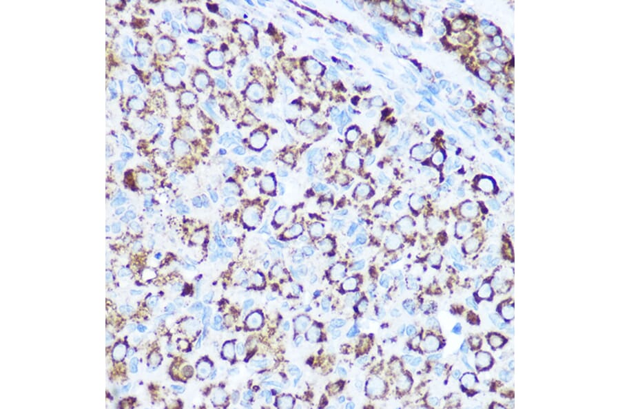 Immunohistochemistry - Anti-SOD2/MnSOD Antibody (A13432) - Antibodies.com