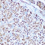 Immunohistochemistry - Anti-SOD2/MnSOD Antibody (A13432) - Antibodies.com
