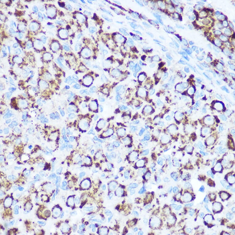 Immunohistochemistry - Anti-SOD2/MnSOD Antibody (A13432) - Antibodies.com
