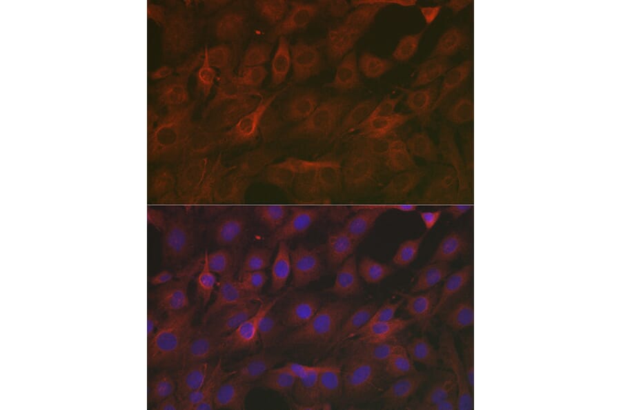 Immunofluorescence - Anti-SOD2/MnSOD Antibody (A13432) - Antibodies.com
