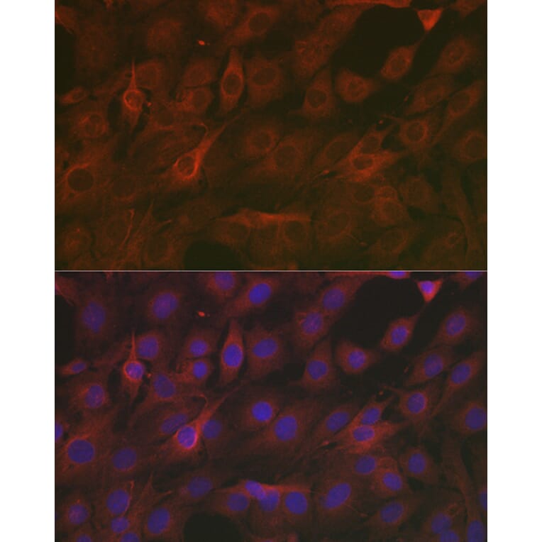 Immunofluorescence - Anti-SOD2/MnSOD Antibody (A13432) - Antibodies.com