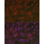 Immunofluorescence - Anti-SOD2/MnSOD Antibody (A13432) - Antibodies.com