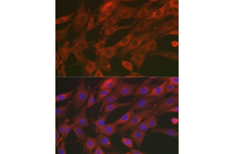 Immunofluorescence - Anti-SOD2/MnSOD Antibody (A13432) - Antibodies.com