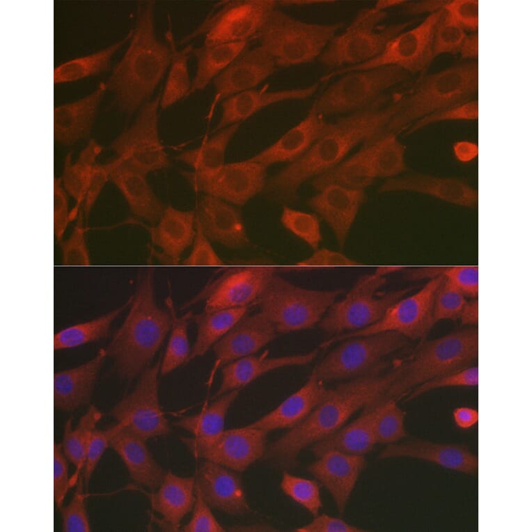 Immunofluorescence - Anti-SOD2/MnSOD Antibody (A13432) - Antibodies.com