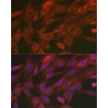 Immunofluorescence - Anti-SOD2/MnSOD Antibody (A13432) - Antibodies.com