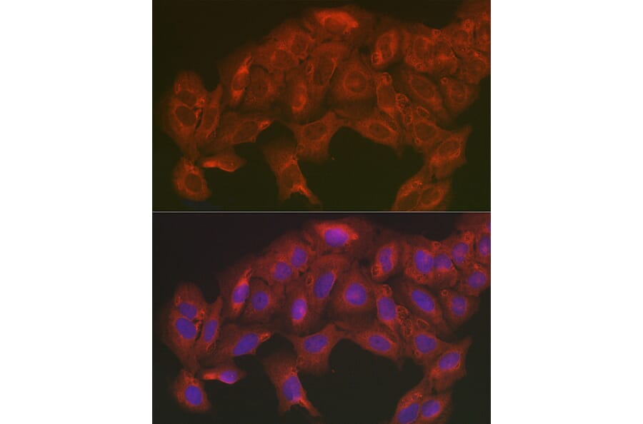 Immunofluorescence - Anti-SOD2/MnSOD Antibody (A13432) - Antibodies.com