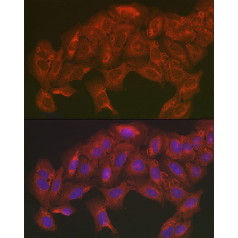Immunofluorescence - Anti-SOD2/MnSOD Antibody (A13432) - Antibodies.com