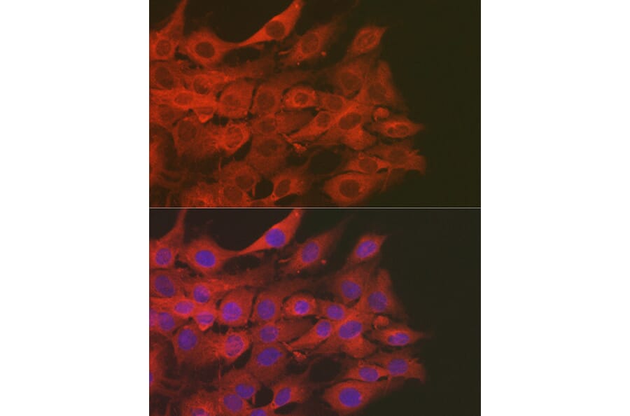Immunofluorescence - Anti-SOD2/MnSOD Antibody (A13432) - Antibodies.com