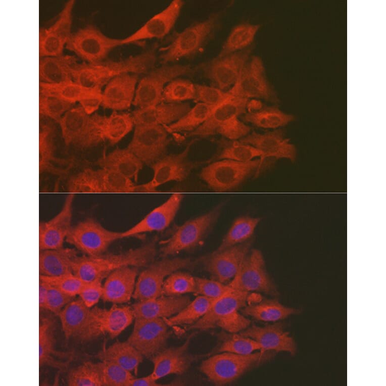 Immunofluorescence - Anti-SOD2/MnSOD Antibody (A13432) - Antibodies.com