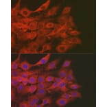Immunofluorescence - Anti-SOD2/MnSOD Antibody (A13432) - Antibodies.com