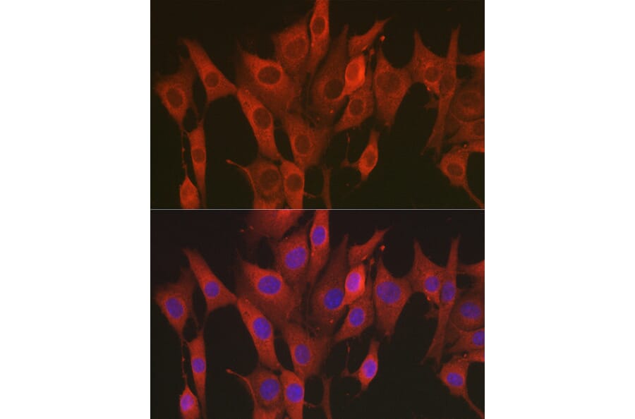 Immunofluorescence - Anti-SOD2/MnSOD Antibody (A13432) - Antibodies.com