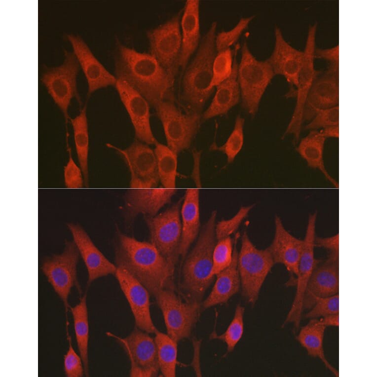 Immunofluorescence - Anti-SOD2/MnSOD Antibody (A13432) - Antibodies.com
