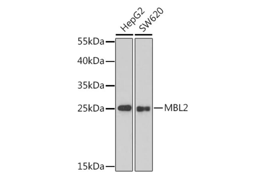 Western Blot - Anti-MBL2 Antibody (A1341) - Antibodies.com