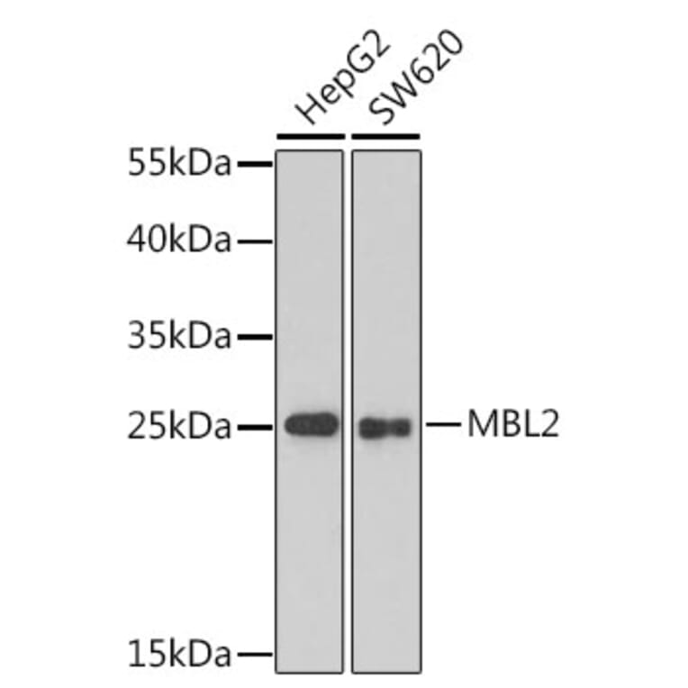 Western Blot - Anti-MBL2 Antibody (A1341) - Antibodies.com