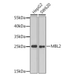 Western Blot - Anti-MBL2 Antibody (A1341) - Antibodies.com