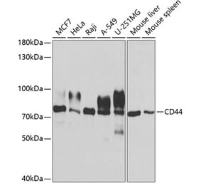 Western Blot - Anti-CD44 Antibody (A13435) - Antibodies.com
