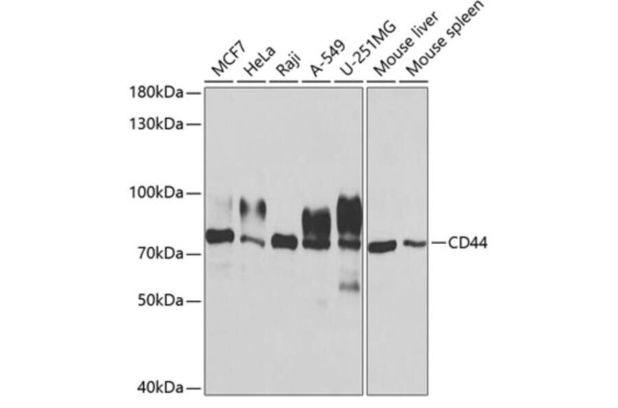 Western Blot - Anti-CD44 Antibody (A13435) - Antibodies.com