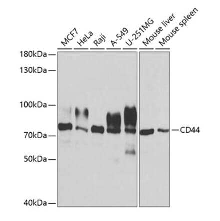 Western Blot - Anti-CD44 Antibody (A13435) - Antibodies.com