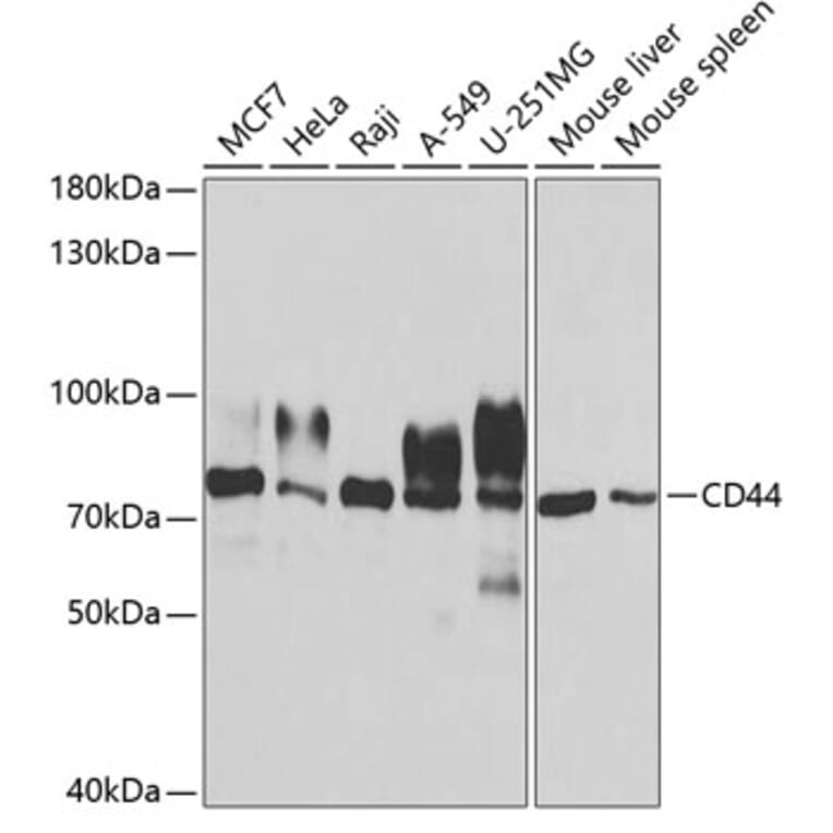 Western Blot - Anti-CD44 Antibody (A13435) - Antibodies.com