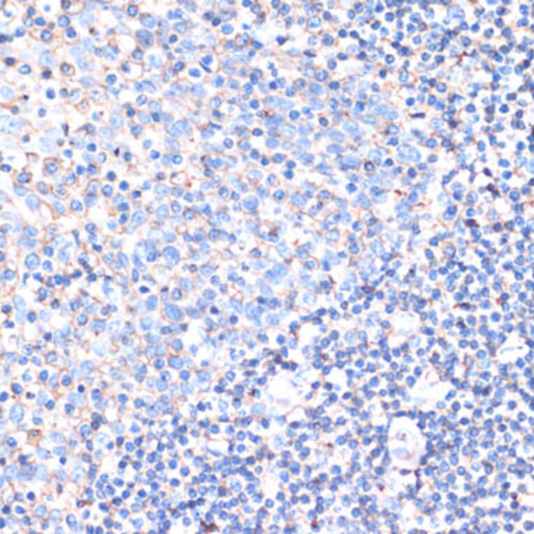 Immunohistochemistry - Anti-CD44 Antibody (A13435) - Antibodies.com