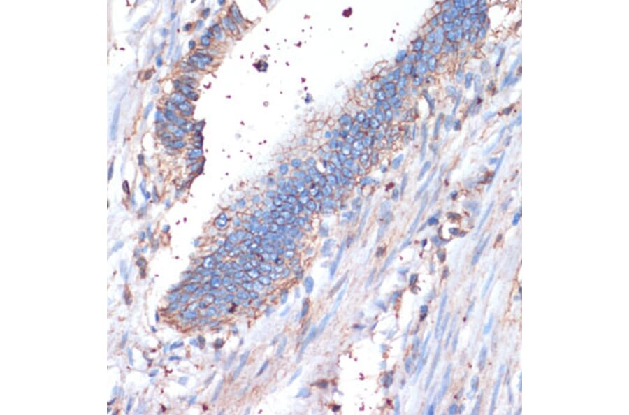 Immunohistochemistry - Anti-CD44 Antibody (A13435) - Antibodies.com