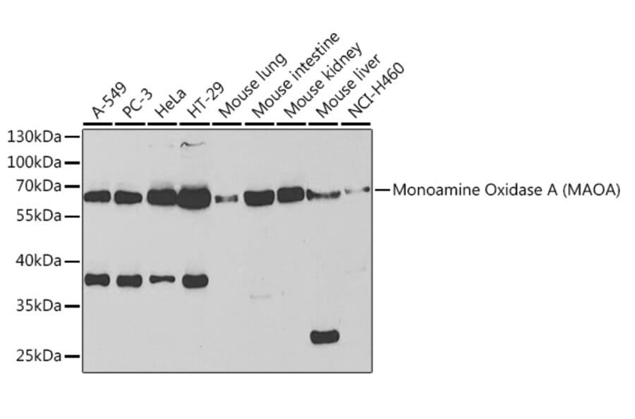 Western Blot - Anti-Monoamine Oxidase A/MAO-A Antibody (A13436) - Antibodies.com
