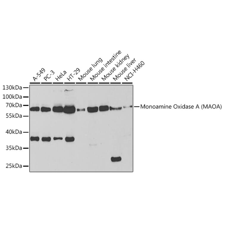 Western Blot - Anti-Monoamine Oxidase A/MAO-A Antibody (A13436) - Antibodies.com