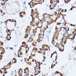 Immunohistochemistry - Anti-Monoamine Oxidase A/MAO-A Antibody (A13436) - Antibodies.com