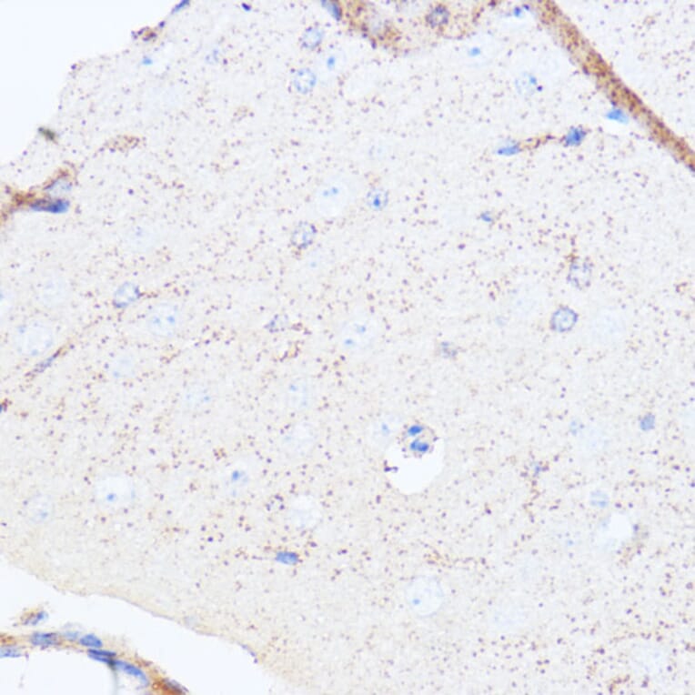 Immunohistochemistry - Anti-Monoamine Oxidase A/MAO-A Antibody (A13436) - Antibodies.com