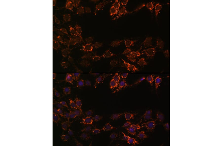 Immunofluorescence - Anti-Monoamine Oxidase A/MAO-A Antibody (A13436) - Antibodies.com