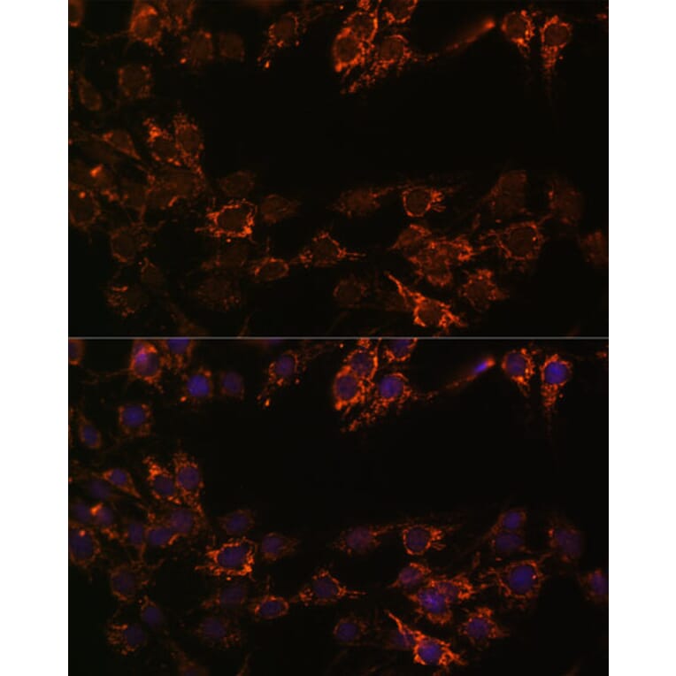 Immunofluorescence - Anti-Monoamine Oxidase A/MAO-A Antibody (A13436) - Antibodies.com