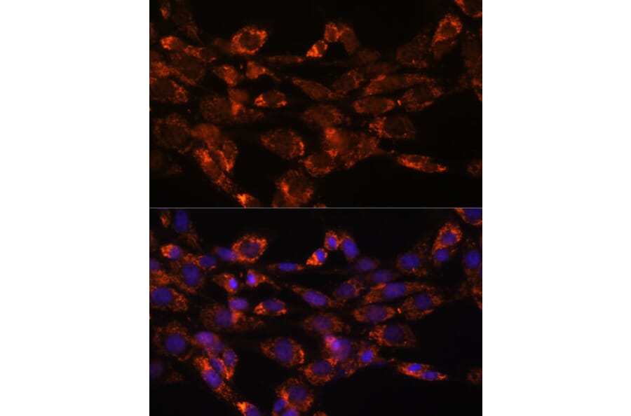 Immunofluorescence - Anti-Monoamine Oxidase A/MAO-A Antibody (A13436) - Antibodies.com