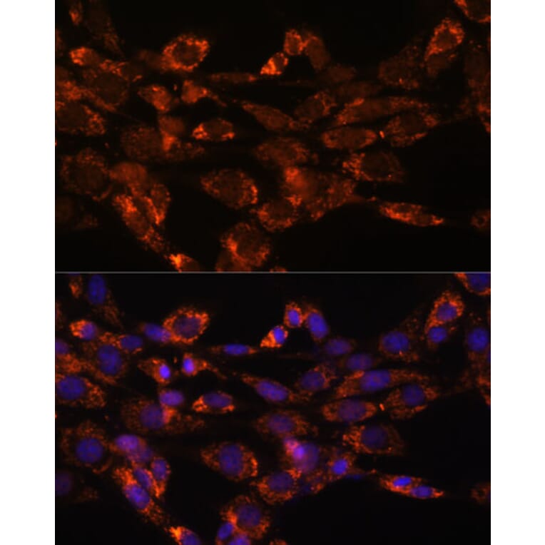 Immunofluorescence - Anti-Monoamine Oxidase A/MAO-A Antibody (A13436) - Antibodies.com