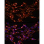 Immunofluorescence - Anti-Monoamine Oxidase A/MAO-A Antibody (A13436) - Antibodies.com