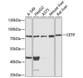 Western Blot - Anti-CETP Antibody (A13437) - Antibodies.com