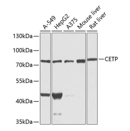 Western Blot - Anti-CETP Antibody (A13437) - Antibodies.com