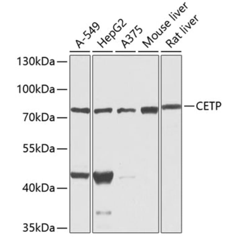 Western Blot - Anti-CETP Antibody (A13437) - Antibodies.com