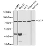 Western Blot - Anti-CETP Antibody (A13437) - Antibodies.com