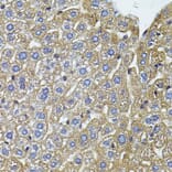 Immunohistochemistry - Anti-CETP Antibody (A13437) - Antibodies.com