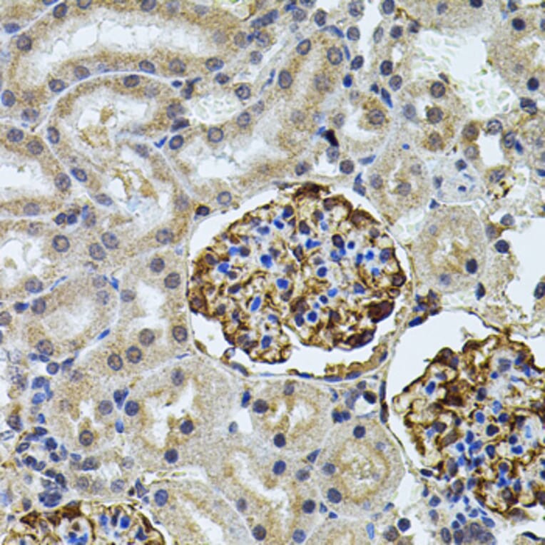 Immunohistochemistry - Anti-CETP Antibody (A13437) - Antibodies.com