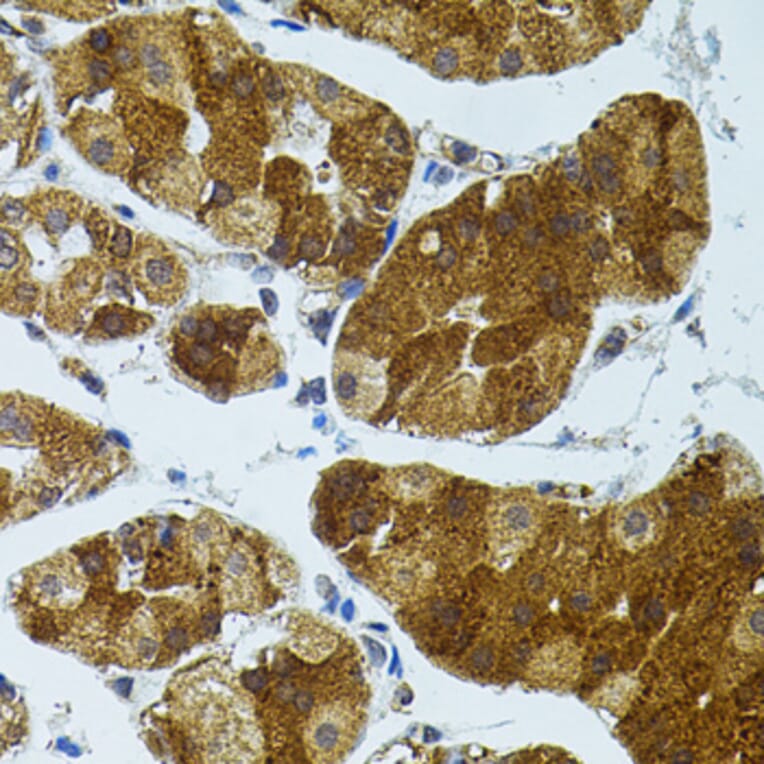 Immunohistochemistry - Anti-CETP Antibody (A13437) - Antibodies.com