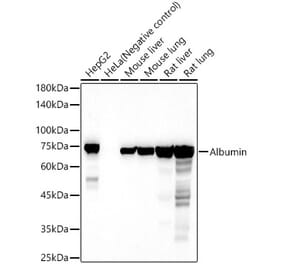 Western Blot - Anti-Albumin Antibody (A13438) - Antibodies.com