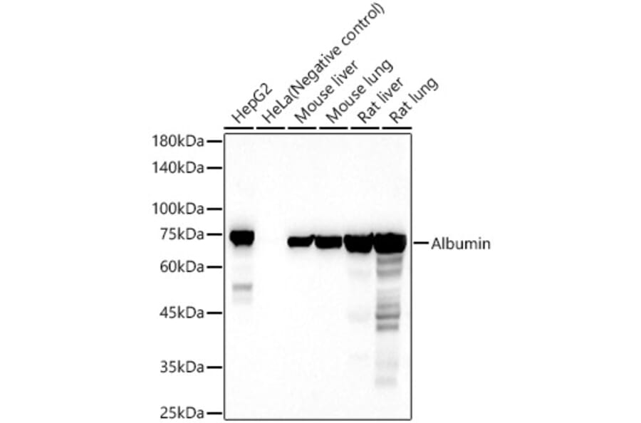 Western Blot - Anti-Albumin Antibody (A13438) - Antibodies.com