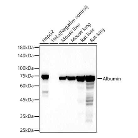 Western Blot - Anti-Albumin Antibody (A13438) - Antibodies.com