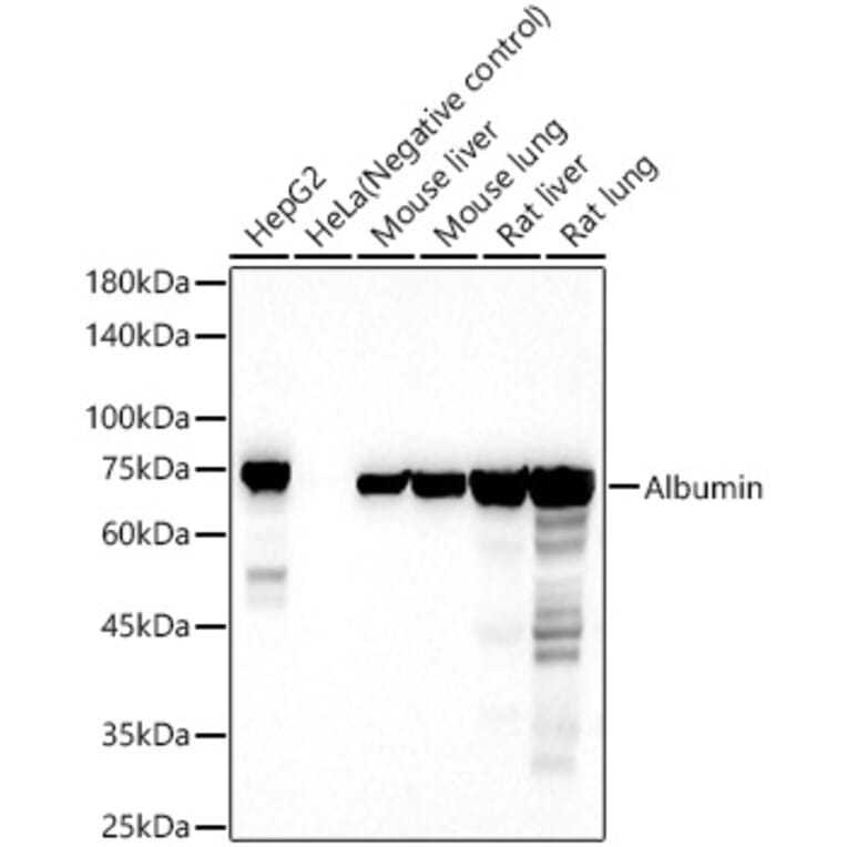 Western Blot - Anti-Albumin Antibody (A13438) - Antibodies.com