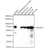 Western Blot - Anti-Albumin Antibody (A13438) - Antibodies.com