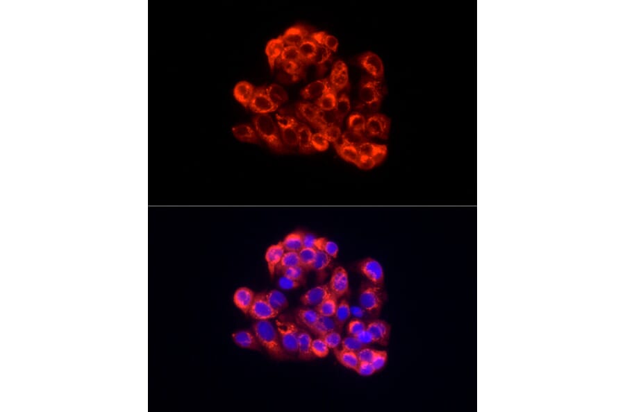 Immunofluorescence - Anti-Albumin Antibody (A13438) - Antibodies.com